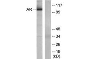 Western blot analysis of extracts from LOVO cells, using Androgen Receptor (Ab-650) Antibody. (Androgen Receptor 抗体  (AA 621-670))