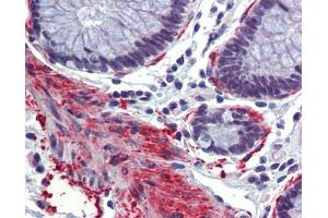 Immunohistochemistry (IHC) image for anti-CREB Binding Protein (CREBBP) (N-Term) antibody (ABIN2781491)