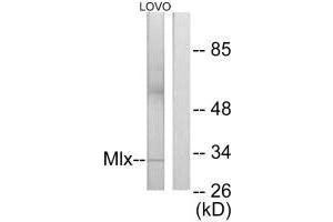 Western blot analysis of extracts from LOVO cells, using Mlx antibody. (MLX 抗体)