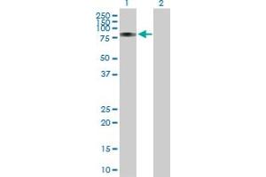 Western Blot analysis of RUNX1T1 expression in transfected 293T cell line by RUNX1T1 MaxPab polyclonal antibody. (RUNX1T1 抗体  (AA 1-577))
