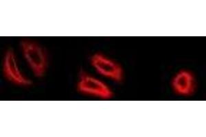 Immunofluorescent analysis of RNase 13 staining in MCF7 cells. (RNASE13 抗体)