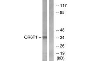 Western Blotting (WB) image for anti-Olfactory Receptor, Family 6, Subfamily T, Member 1 (OR6T1) (AA 264-313) antibody (ABIN2891046) (OR6T1 抗体  (AA 264-313))