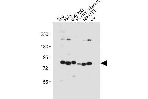 All lanes : Anti-cGKI (cGKI beta) Antibody (C-term) at 1:1000 dilution Lane 1: 293 whole cell lysate Lane 2: Hela whole cell lysate Lane 3: U-87 MG whole cell lysate Lane 4: Mouse small intestine tissue lysate Lane 5: NIH/3T3 whole cell lysate Lane 6: C6 whole cell lysate Lysates/proteins at 20 μg per lane. (PRKG1 抗体  (C-Term))