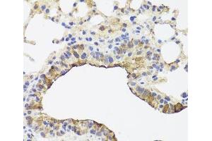 Immunohistochemistry of paraffin-embedded Mouse lung using TOMM34 Polyclonal Antibody at dilution of 1:100 (40x lens). (TOMM34 抗体)