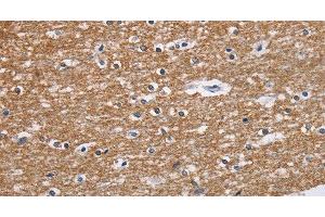 Immunohistochemistry of paraffin-embedded Human brain tissue using NCR2 Polyclonal Antibody at dilution 1:60 (NKp44/NCR2 抗体)