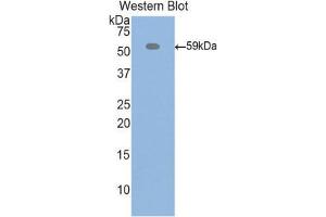 Western Blotting (WB) image for anti-Inter alpha Globulin Inhibitor H4 (ITIH4) (AA 478-722) antibody (ABIN1859513) (ITIH4 抗体  (AA 478-722))