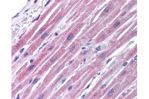 Anti-GJA5 / Connexin 40 antibody IHC of human heart. (Cx40/GJA5 抗体  (AA 86-135))