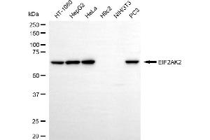 Western blotting analysis using EIF2AK2 antibody (ABIN7798508). (Recombinant EIF2AK2 抗体)