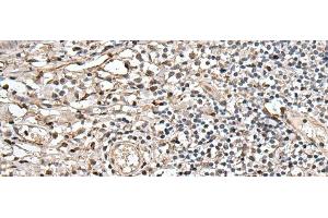 Immunohistochemistry of paraffin-embedded Human tonsil tissue using UTP3 Polyclonal Antibody at dilution of 1:40(x200)