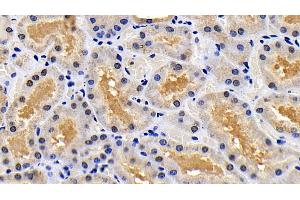 Detection of XIAP in Human Kidney Tissue using Polyclonal Antibody to X-linked Inhibitor Of Apoptosis Protein (XIAP) (XIAP 抗体  (AA 1-497))