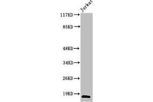 Western Blot analysis of Jurkat cells using Cleaved-Caspase-2 p18 (G170) Polyclonal Antibody (Caspase 2 抗体  (Cleaved-Gly170))