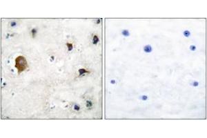 Immunohistochemistry analysis of paraffin-embedded human brain tissue, using Connexin 43 Antibody. (Connexin 43/GJA1 抗体  (AA 333-382))
