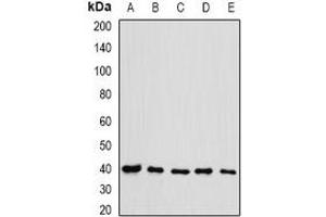Western blot analysis of eIF3H expression in HL60 (A), HT29 (B), NIH3T3 (C), mouse testis (D), rat spleen (E) whole cell lysates. (EIF3H 抗体)
