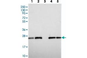 Western blot analysis of Lane 1: RT-4, Lane 2: U-251 MG, Lane 3: Human Plasma, Lane 4: Liver, Lane 5: Tonsil with C9orf142 polyclonal antibody  at 1:250-1:500 dilution. (C9orf142 抗体)