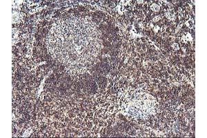 Immunohistochemistry (IHC) image for anti-PDZ and LIM Domain 2 (PDLIM2) antibody (ABIN1500130) (PDLIM2 抗体)
