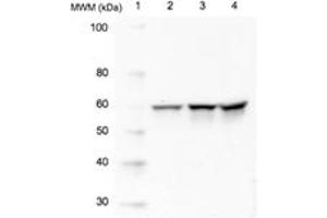 Western blot analysis of Src using 20 μg of whole cell lysate (Lane 2=HeLa, Lane 3=3T3, Lane 4=PC12) probed with with Src, mAb (5A18) at 1 μg/mL. (CSK 抗体)