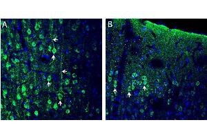 Expression of CX3CL1 in rat frontal cortex - Immunohistochemical staining of perfusion-fixed frozen rat brain sections with Anti-CX3CL1 (extracellular) Antibody (ABIN7043045, ABIN7044192 and ABIN7044193), (1:200), followed by goat anti-rabbit-AlexaFluor-488. (CX3CL1 抗体  (Extracellular))