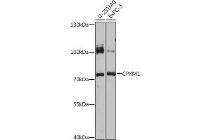 Western blot analysis of extracts of various cell lines, using CPXM1 antibody (ABIN7266082) at 1:1000 dilution. (CPXM1 抗体)