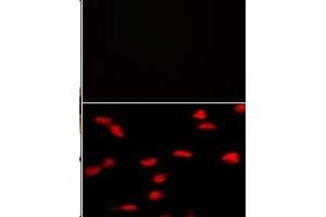 (TOP)Negative control of hela cells without PE-conjugated goat anti-mouse lgG (whole molecule). (SETD8 抗体  (N-Term))