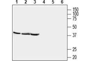Western blot analysis of rat brain lysate (lanes 1 and 4), mouse brain lysate (lanes 2 and 5) and rat skeletal muscle lysate (lanes 3 and 6): - 1-3. (STOML2 抗体  (Intracellular))