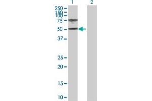 Western Blot analysis of HGD expression in transfected 293T cell line by HGD MaxPab polyclonal antibody.