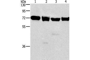 Western Blot analysis of 231, 293T, Raji and hela cell using IL2RB Polyclonal Antibody at dilution of 1:325 (IL2 Receptor beta 抗体)