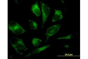 Immunofluorescence of monoclonal antibody to GSTM2 on HeLa cell. (GSTM2 抗体  (AA 90-189))