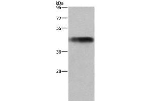 Western Blot analysis of Human fetal liver tissue using GALT Polyclonal Antibody at dilution of 1:300 (GALT 抗体)