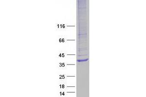 Validation with Western Blot