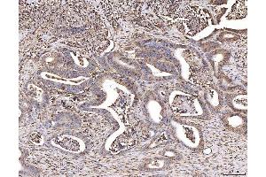 IHC analysis of CBL using anti-CBL antibody (ABIN7601820).