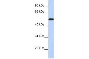 WB Suggested Anti-HOXA3 Antibody Titration:  0. (HOXA3 抗体  (Middle Region))