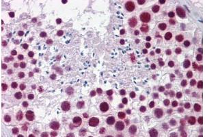 Human Testis: Formalin-Fixed, Paraffin-Embedded (FFPE) (HNRNPH1 抗体  (AA 360-409))