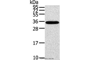 Western blot analysis of Mouse brain tissue, using KCNMB3 Polyclonal Antibody at dilution of 1:300 (KCNMB3 抗体)