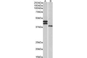 Western Blotting (WB) image for anti-Fc Receptor-Like 1 (FCRL1) (AA 165-177) antibody (ABIN5900722) (FCRL1 抗体  (AA 165-177))
