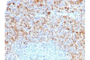 Formalin-fixed, paraffin-embedded human Spleen stained with CD40L-Monospecific Mouse Monoclonal Antibody (CD40LG/2761)