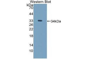 Western blot analysis of the recombinant protein. (ICAM5 抗体  (AA 164-441))