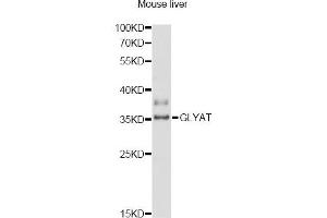 Western blot analysis of extracts of mouse liver, using GLYAT antibody (ABIN6293111) at 1:3000 dilution. (GLYAT 抗体)
