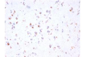 Formalin-fixed, paraffin-embedded human Cerebellum stained with FCGRT Mouse Monoclonal Antibody (FCGRT/2932). (FcRn 抗体  (AA 24-215))