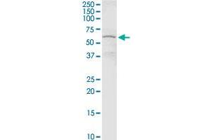 CHEK2 MaxPab rabbit polyclonal antibody. (CHEK2 抗体  (AA 1-543))