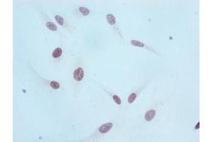 Immunocytochemistry analysis of ABIN7127301 diluted at 1:100 and staining in Hela cells performed on a Leica BondTM system. (Recombinant HIST1H3A 抗体  (H3K36me))
