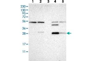 Western blot analysis of Lane 1: RT-4, Lane 2: U-251 MG, Lane 3: Human Plasma, Lane 4: Liver, Lane 5: Tonsil with CA13 polyclonal antibody  at 1:250-1:500 dilution. (CA13 抗体)