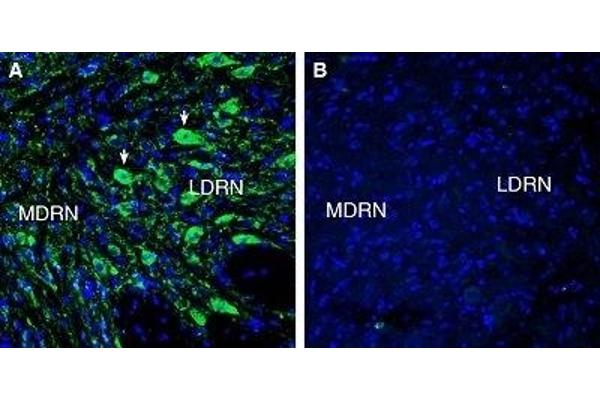 HTR7 抗体  (Extracellular, N-Term)