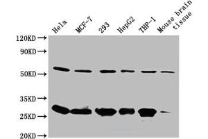Western Blot Positive WB detected in: Mouse spleen tissue All lanes: RPL19 antibody at 2 μg/mL Secondary Goat polyclonal to rabbit IgG at 1/50000 dilution Predicted band size: 24 kDa Observed band size: 24 kDa (RPL19 抗体  (AA 79-196))