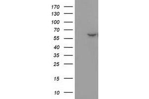 Western Blotting (WB) image for anti-Dystrobrevin alpha (DTNA) antibody (ABIN1497912) (DTNA 抗体)