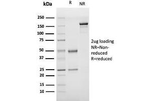 SDS-PAGE Analysis Purified vWF Recombinant Mouse Monoclonal Antibody (rVWF/1465). (Recombinant VWF 抗体  (AA 1815-1939))