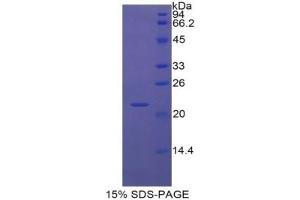 SDS-PAGE of Protein Standard from the Kit  (Highly purified E. (VCAM1 ELISA 试剂盒)