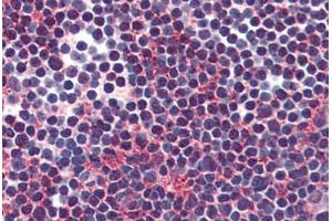 Anti-VIPR2 antibody  ABIN1049457 IHC staining of human thymus. (VIPR2 抗体  (Internal Region))
