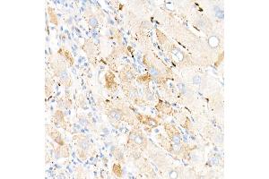 Immunohistochemistry of paraffin-embedded human liver using Perilipin-2 antibody (ABIN7269220) at dilution of 1:1600 (40x lens). (ADRP 抗体)