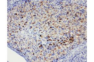 Immunohistochemistry (IHC) image for anti-DEAD Box Protein 4 (DDX4) (AA 253-272), (Middle Region) antibody (ABIN3044032)
