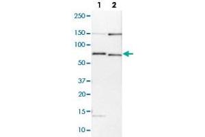 Western blot analysis of Lane 1: NIH-3T3 cell lysate (Mouse embryonic fibroblast cells); Lane 2: NBT-II cell lysate (Rat Wistar bladder tumour cells) with BIRC3 polyclonal antibody  at 1:100-1:250 dilution. (BIRC3 抗体)